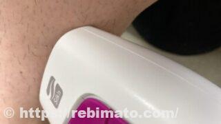 【口コミ・評判】アイリスオーヤマ脱毛器 エピレタ(epilata)使ってみた感想【レビュー】